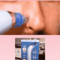 EXTRACTOR DE ESPINILLAS RECARGABLE 🌟🧖🌸